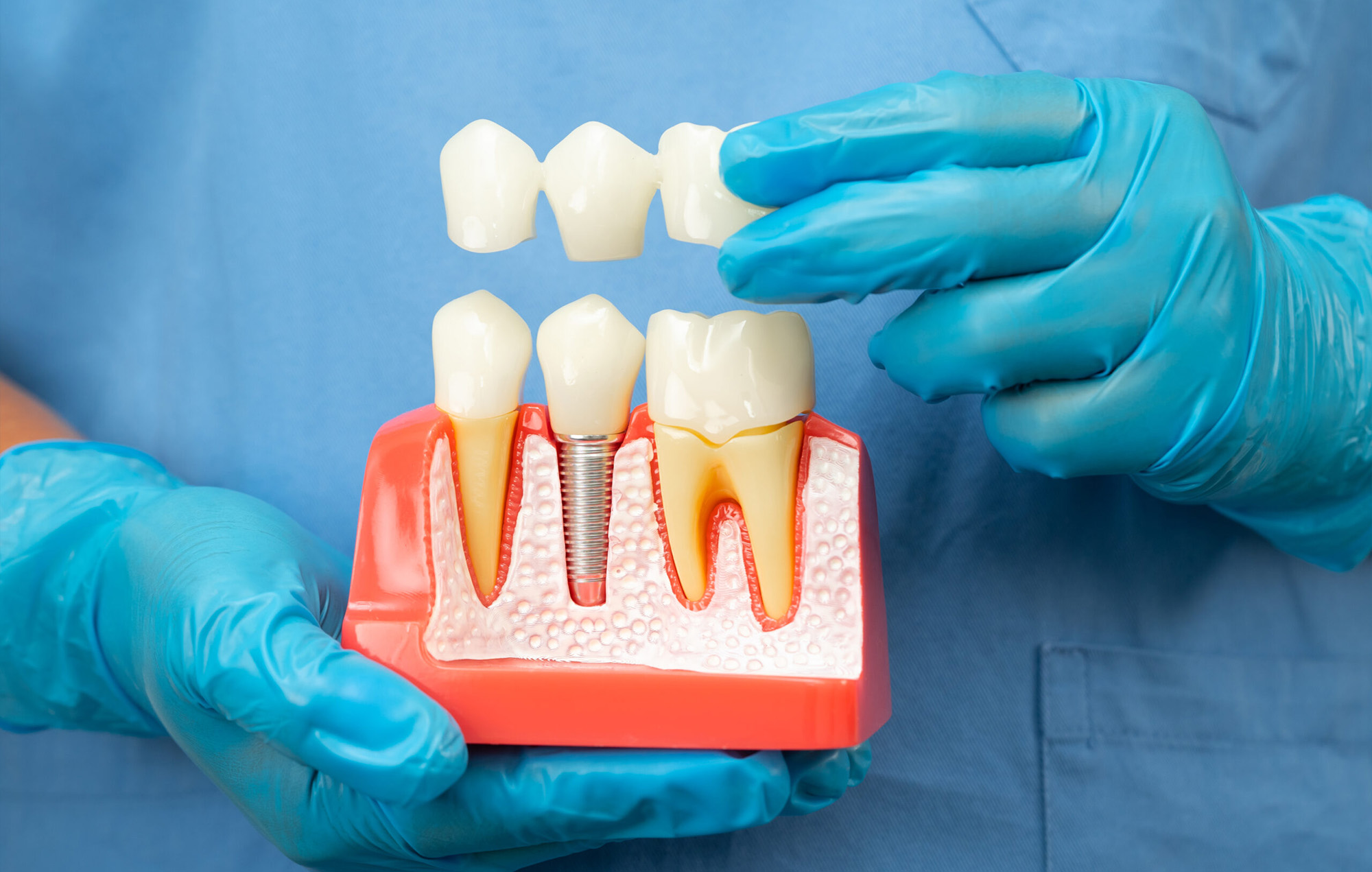 Smile 2 Shine DENTAL CLINIC