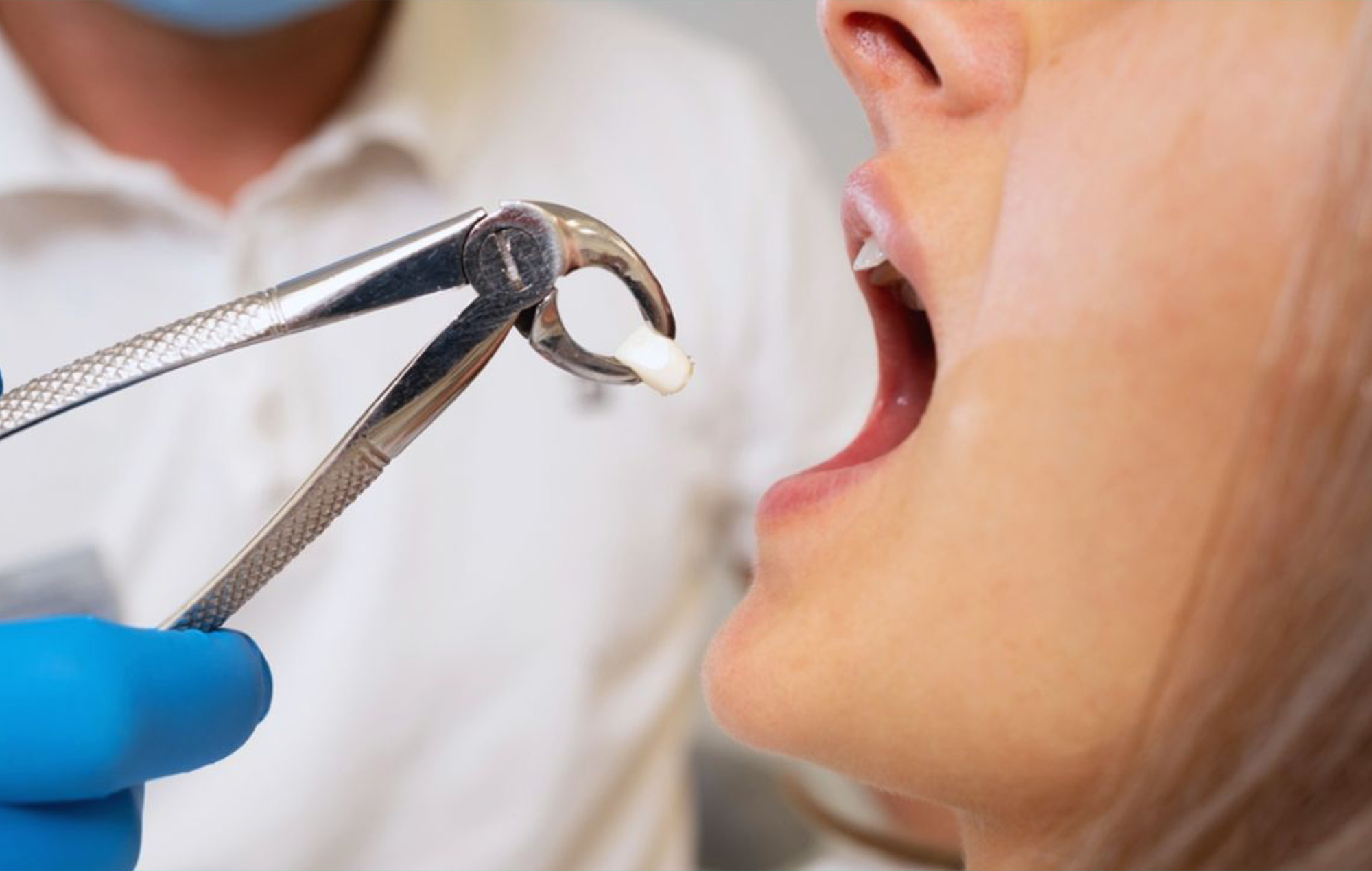Smile 2 Shine DENTAL CLINIC