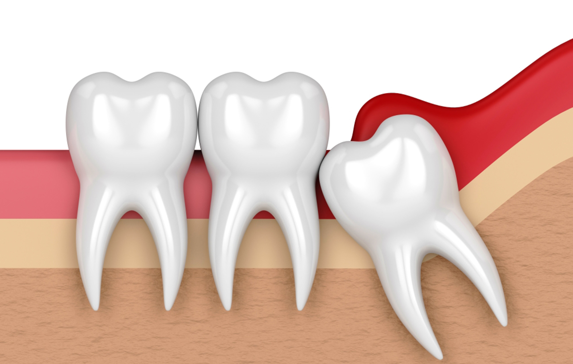 Smile 2 Shine DENTAL CLINIC