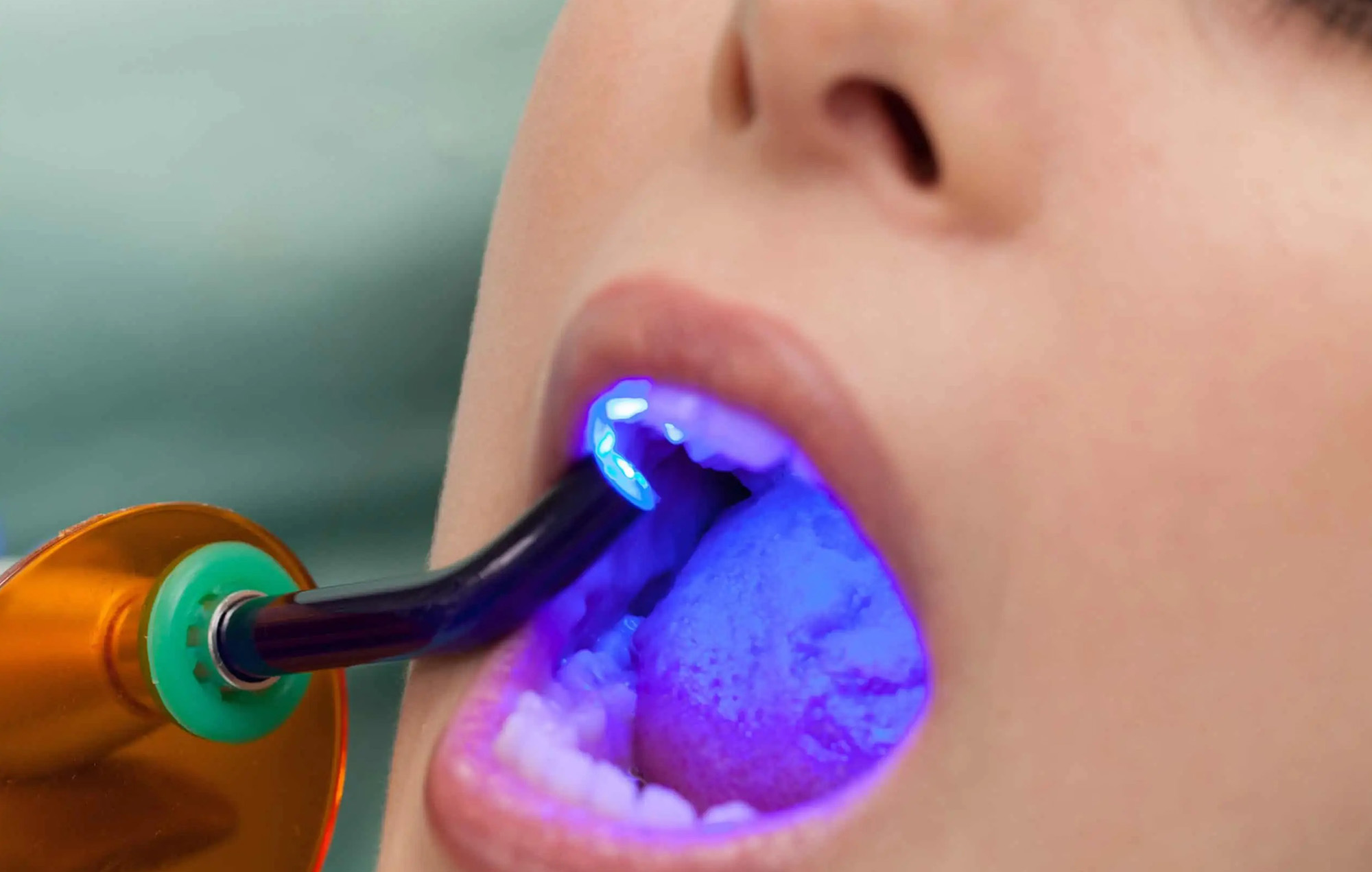 Smile 2 Shine DENTAL CLINIC