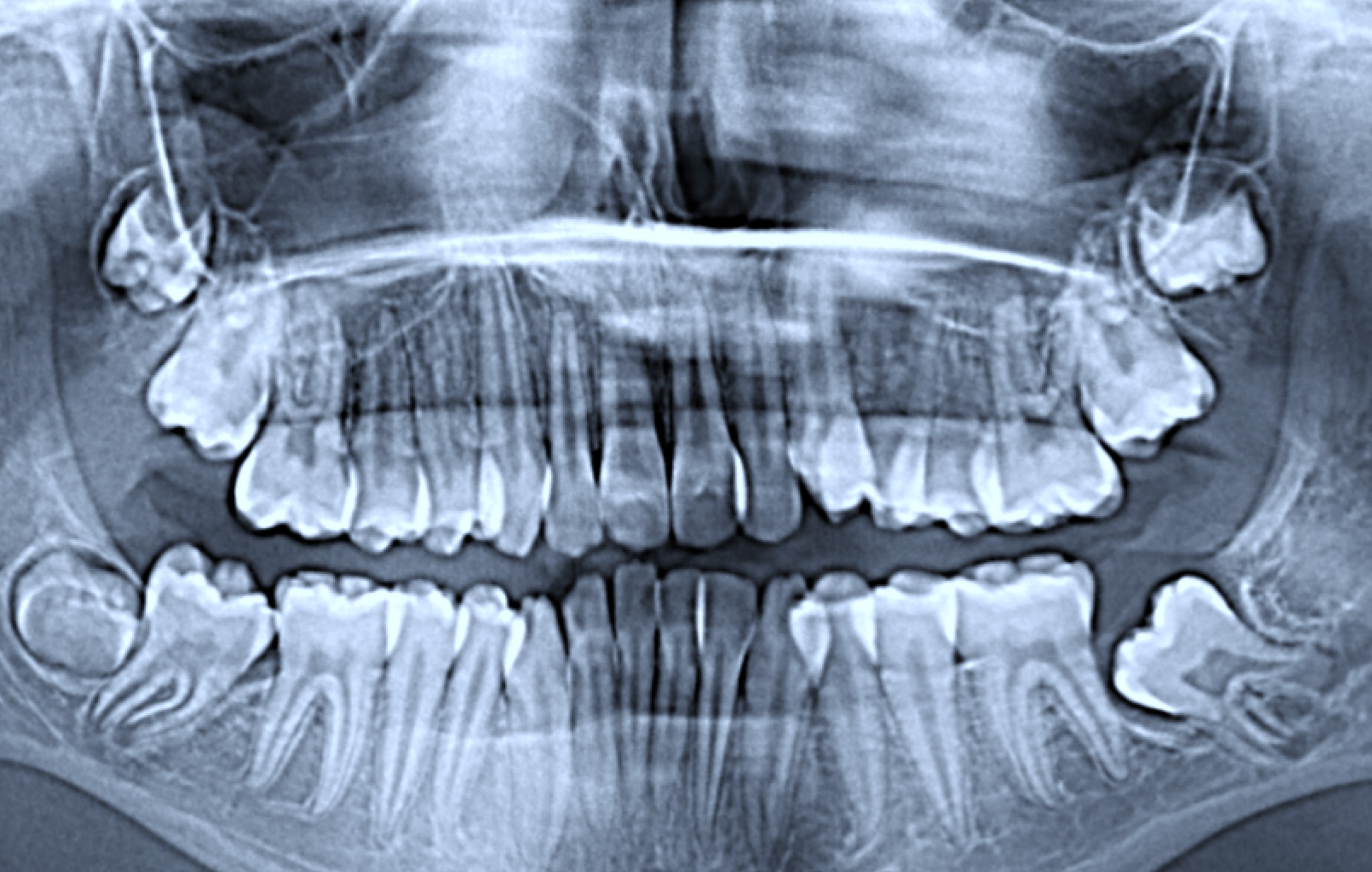 Smile 2 Shine DENTAL CLINIC