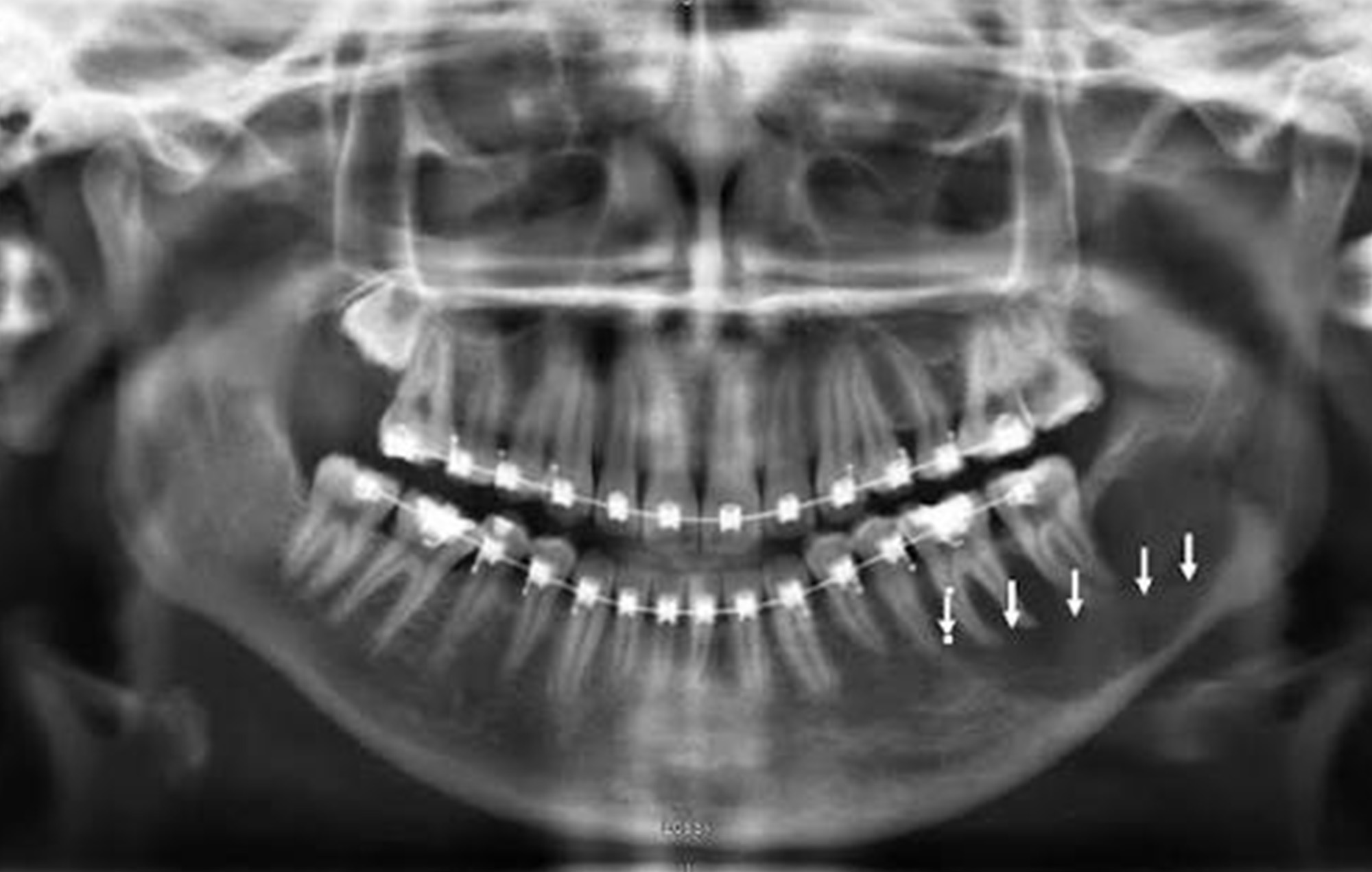 Smile 2 Shine DENTAL CLINIC