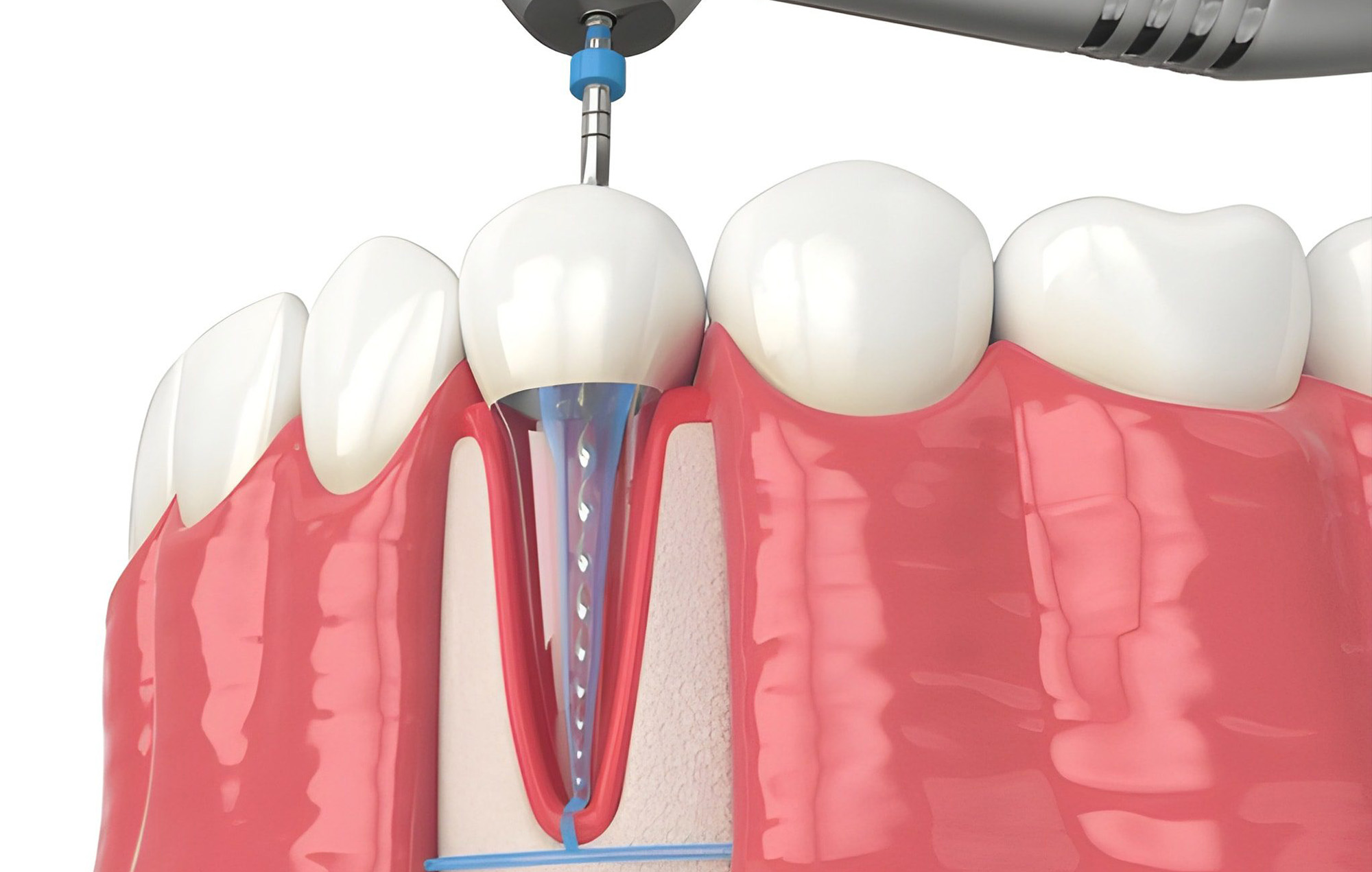 Smile 2 Shine DENTAL CLINIC