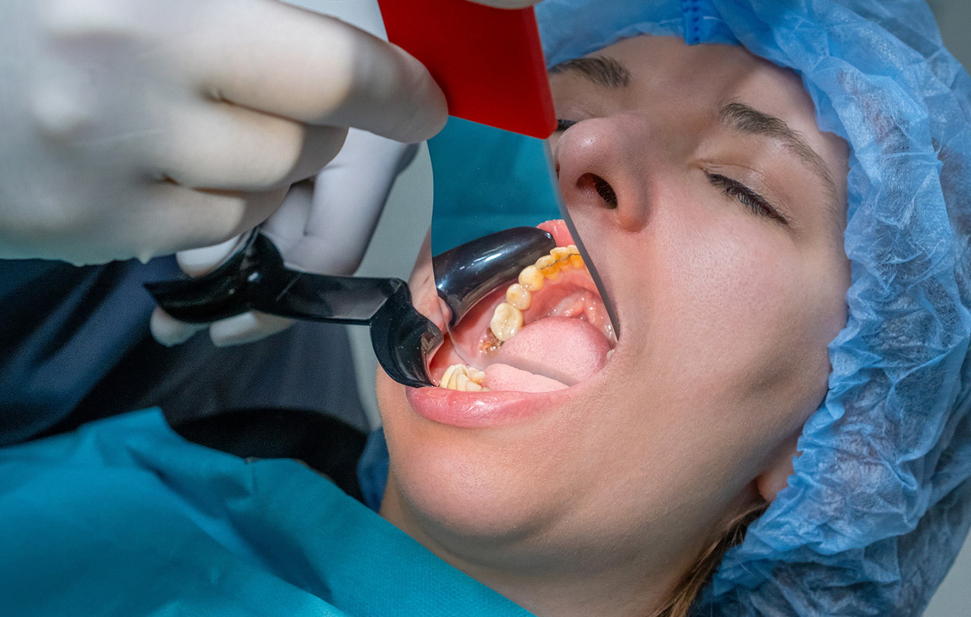Smile 2 Shine DENTAL CLINIC