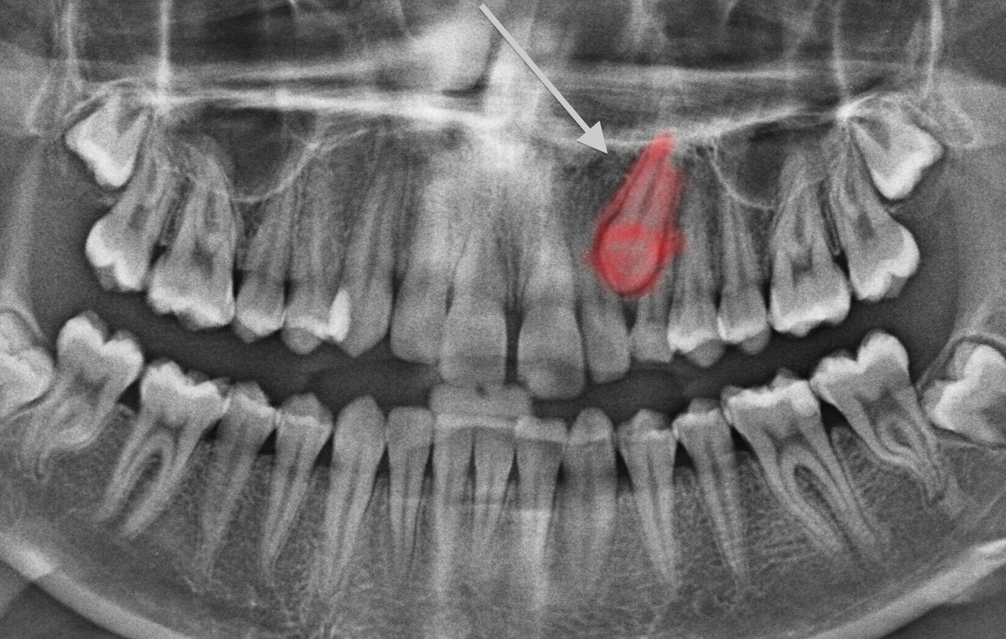 Smile 2 Shine DENTAL CLINIC