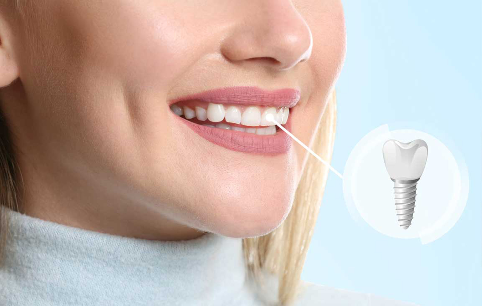 Smile 2 Shine DENTAL CLINIC
