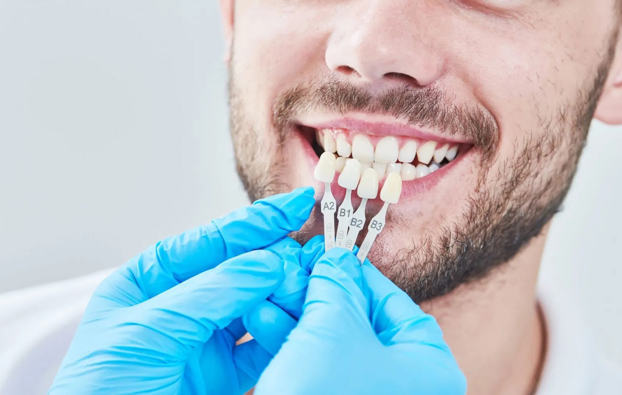 Smile 2 Shine DENTAL CLINIC